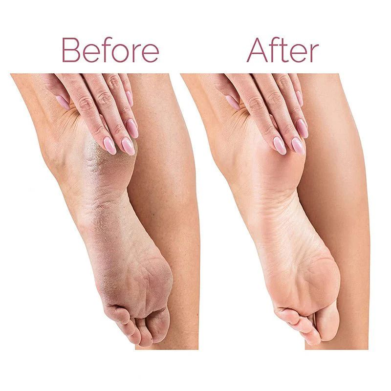 Electric Foot File Front Angle